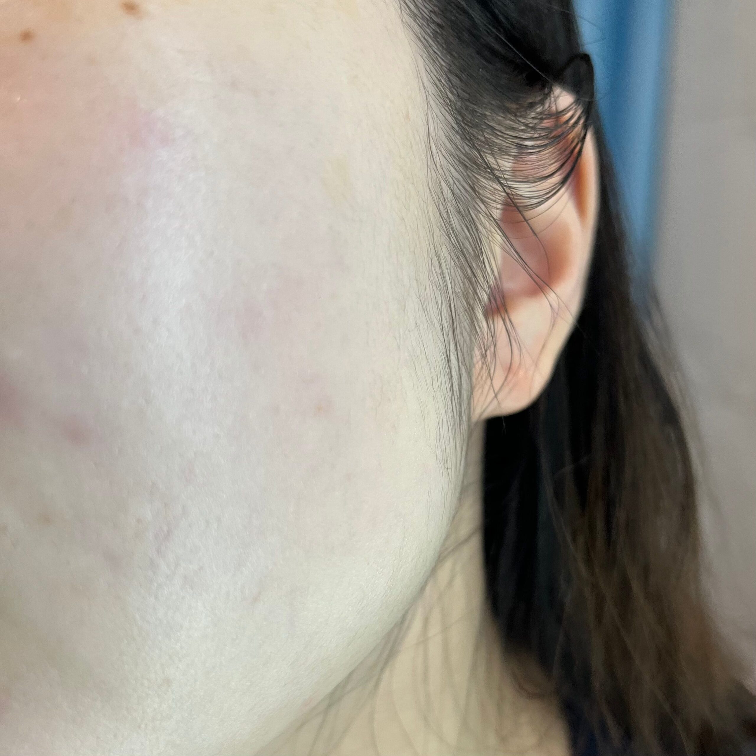ANUA PDRN serum finish on the skin